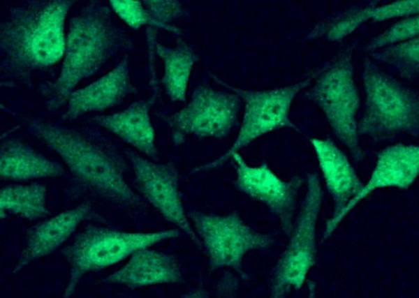 Recombinant Fragile histidine triad/FHIT Monoclonal Antibody (AN300276P)