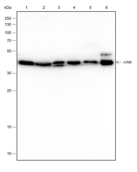 Recombinant JunB Monoclonal Antibody (AN301570L)