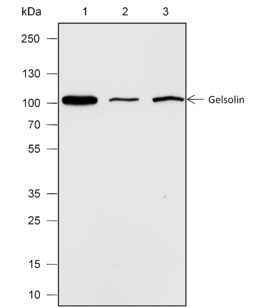 Recombinant Gelsolin Monoclonal Antibody (AN301896L)