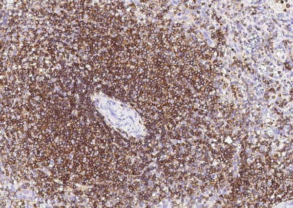 Recombinant CD45/PTPRC Monoclonal Antibody (AN300293P)