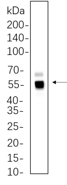 Recombinant Caspase-8 Monoclonal Antibody (AN301327L)