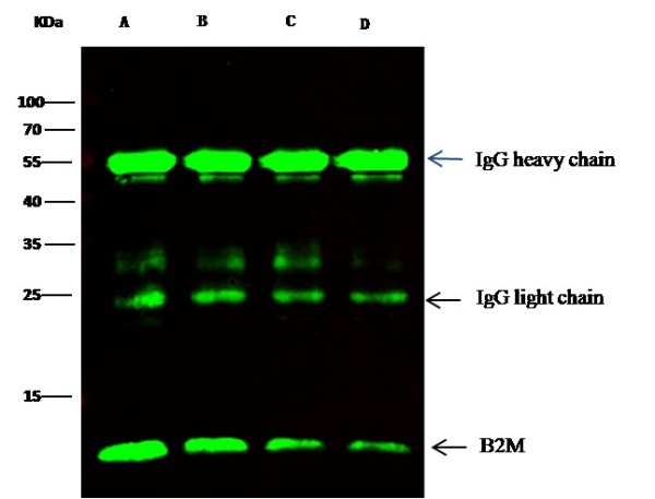 Recombinant B2M/beta-2 microglobulin Monoclonal Antibody (AN300018P)