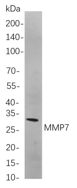 Recombinant MMP7 Monoclonal Antibody (AN300846L)