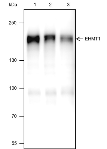 Recombinant EHMT1 Monoclonal Antibody (AN301697L)
