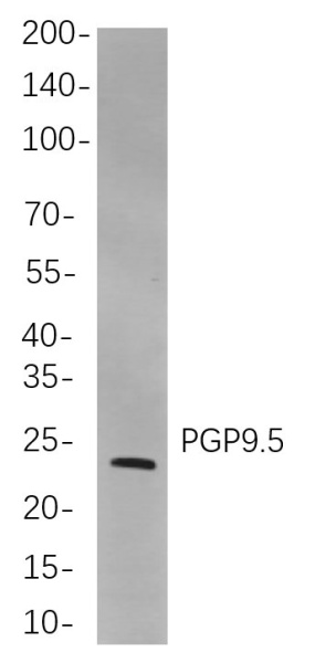 Recombinant PGP9.5 Monoclonal Antibody (AN301038L)