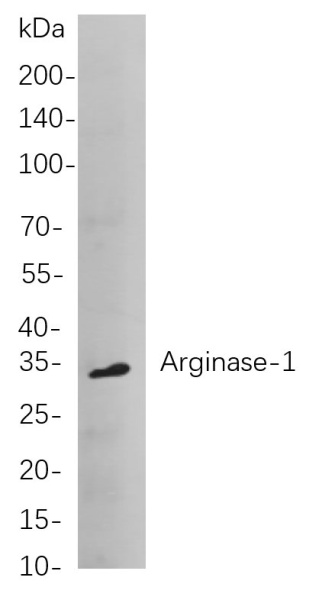 Recombinant Arginase-1 Monoclonal Antibody (AN300873L)