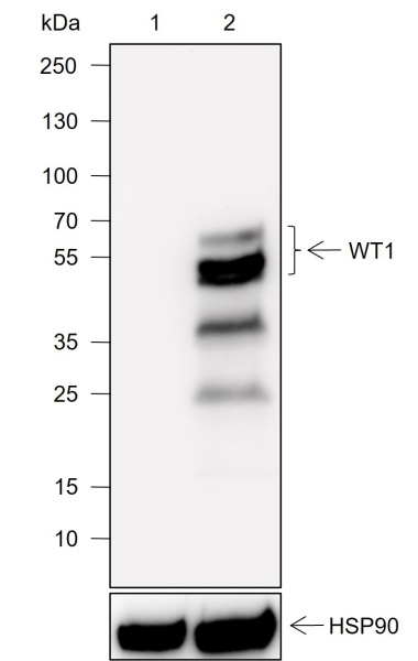 Recombinant WT1 Monoclonal Antibody (AN302022L)
