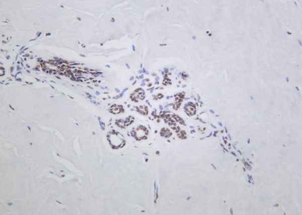 Recombinant Histone H2A.Z Monoclonal Antibody (AN301262L)