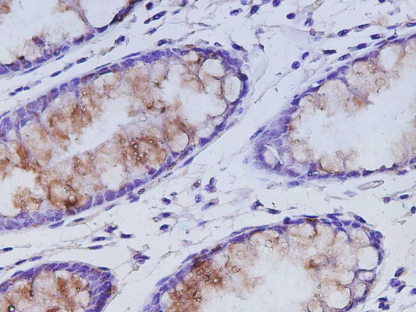 MUC2 Polyclonal Antibody (D-AB-10446L)