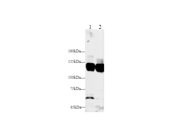 IFNAR1 Polyclonal Antibody (D-AB-10206L)