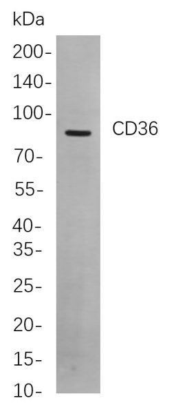 Recombinant CD36 Monoclonal Antibody (AN300923L)