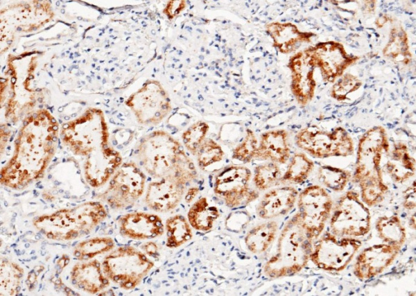 LRPAP1 Monoclonal Antibody (AN200203P)