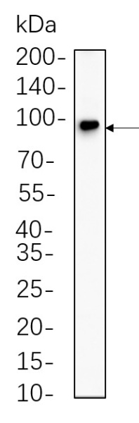 Recombinant Insulin Receptor β Monoclonal Antibody (AN300676L)