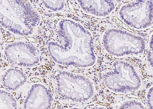 ICAM-1/CD54 Monoclonal Antibody (AN200004P)