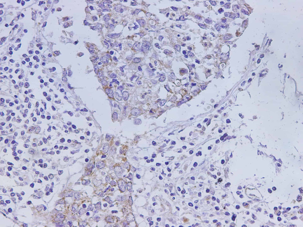 CEACAM1 Polyclonal Antibody (D-AB-10227L)