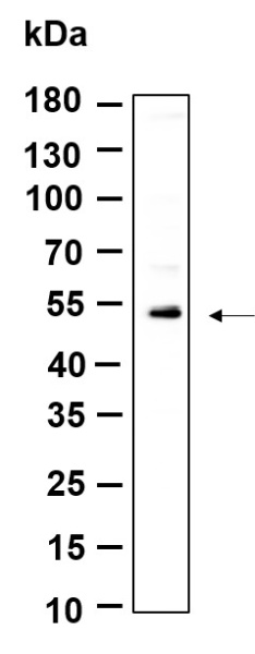 Recombinant KRTHB3 Monoclonal Antibody (AN301195L)