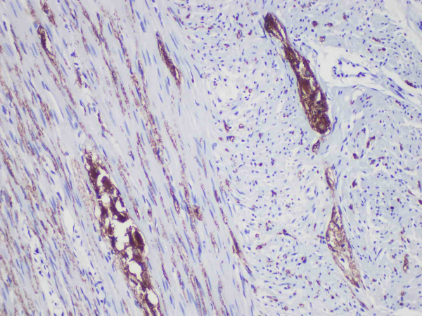 Synaptophysin(Syn) Monoclonal Antibody (ELAB6098-R)