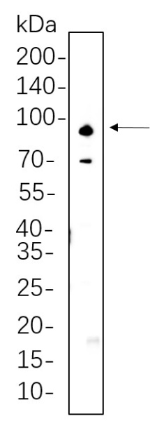 Recombinant ADAM10 Monoclonal Antibody (AN300633L)