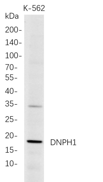 Recombinant DNPH1 Monoclonal Antibody (AN300765L)
