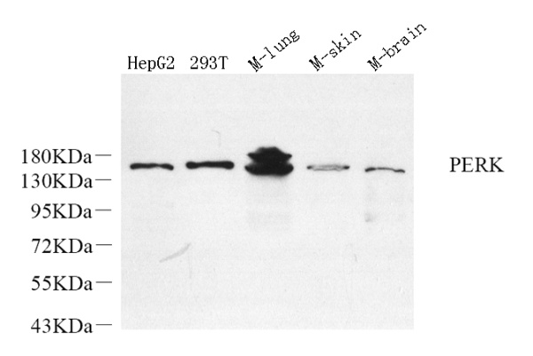 PERK Polyclonal Antibody (E-AB-70366)