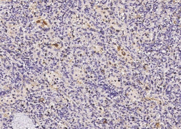 Recombinant FOLR2 Monoclonal Antibody (AN300228P)