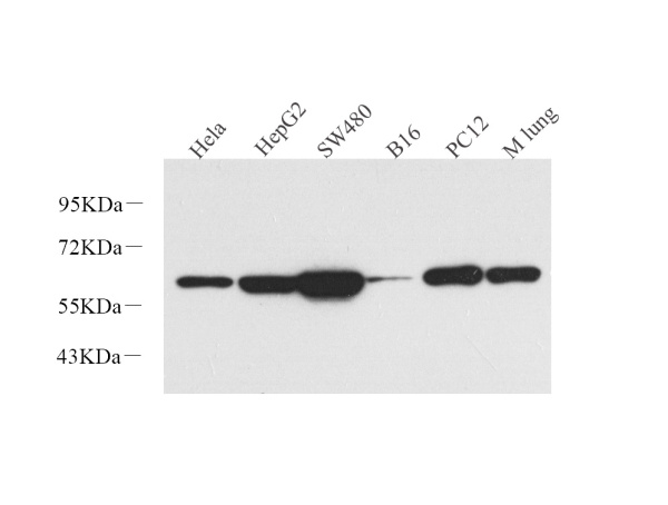 Vimentin Polyclonal Antibody (E-AB-70081)