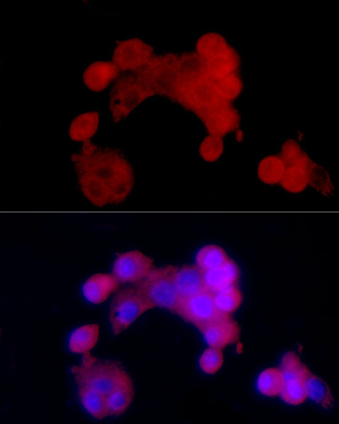SIRT2 Polyclonal Antibody (E-AB-64930)