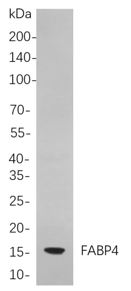 Recombinant FABP4 Monoclonal Antibody (AN301047L)