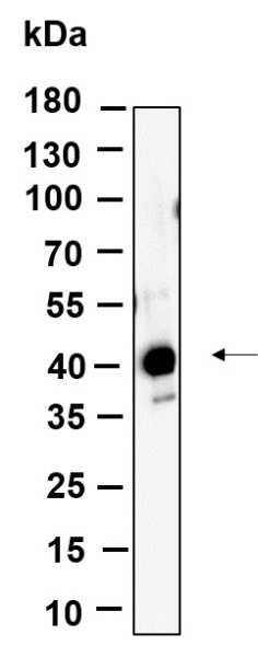 Recombinant FBX32 Monoclonal Antibody (AN301124L)