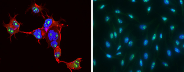 CCNE1/Cyclin-E1 Monoclonal Antibody (AN200192P)