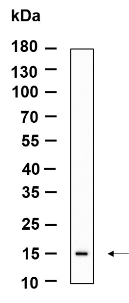 Recombinant LGALS14 Monoclonal Antibody (AN301202L)