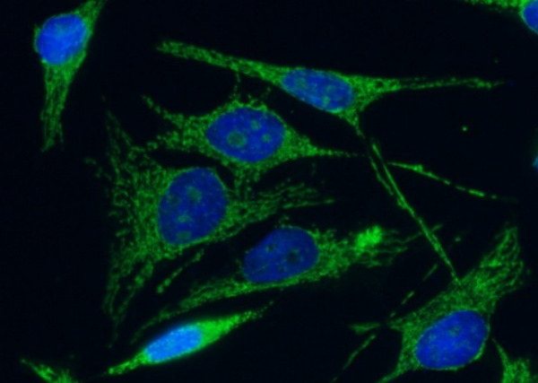 C1QBP/HABP1 Monoclonal Antibody (AN200043P)