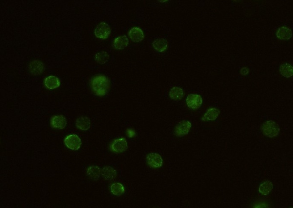 Recombinant CD132/IL2RG Monoclonal Antibody (AN300473P)