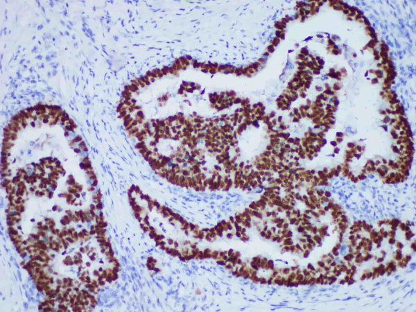 p53 Monoclonal Antibody (ELAB5014-M)