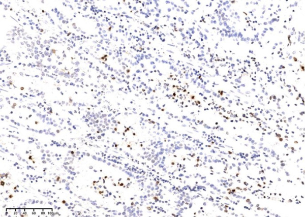 Recombinant Phospho-Histone H2A.X (Ser139) Monoclonal Antibody (AN300358L)