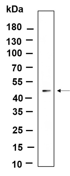 Recombinant ILK Monoclonal Antibody (AN301171L)