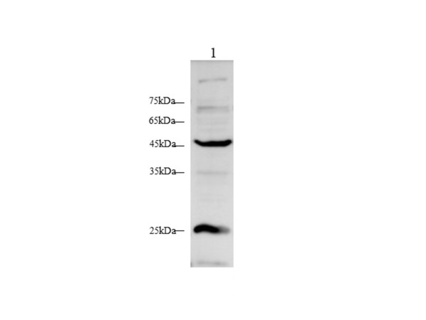 ACTα2 Polyclonal Antibody (D-AB-10442L)