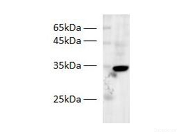 Zebrafish PPP1R3G Polyclonal Antibody (E-AB-40563)