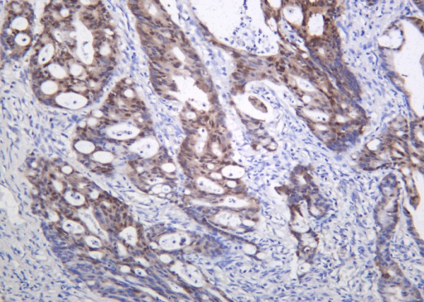 Recombinant CDX2 Monoclonal Antibody (AN301246L)