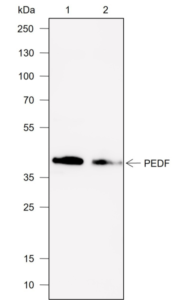 Recombinant PEDF Monoclonal Antibody (AN301984L)