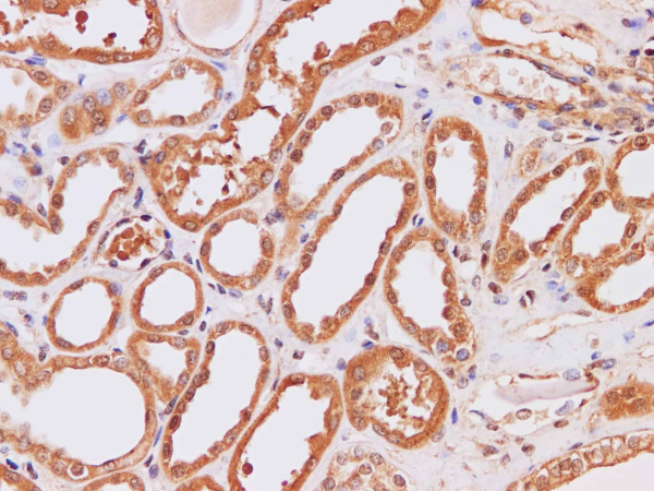 IP3KB Polyclonal Antibody (E-AB-40215)
