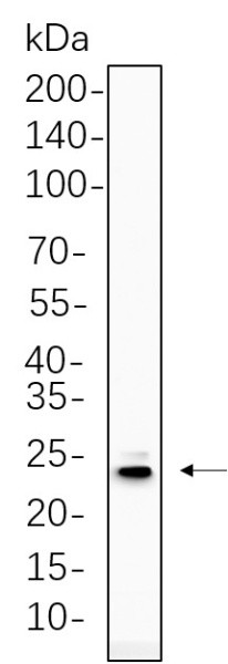 Recombinant PUMA Monoclonal Antibody (AN300815L)