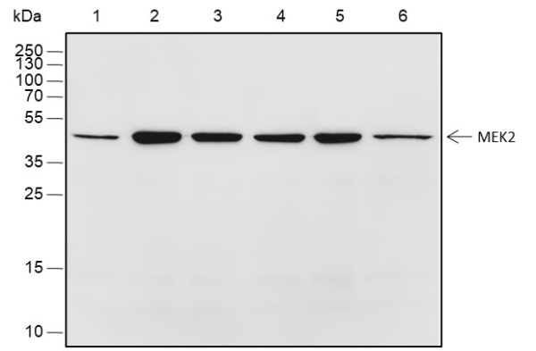 Recombinant MEK2 Monoclonal Antibody (AN301599L)