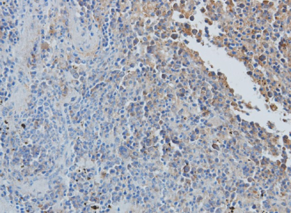 CCL7 Polyclonal Antibody (E-AB-40149)
