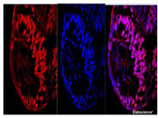 Ki67 Polyclonal Antibody (E-AB-40528)
