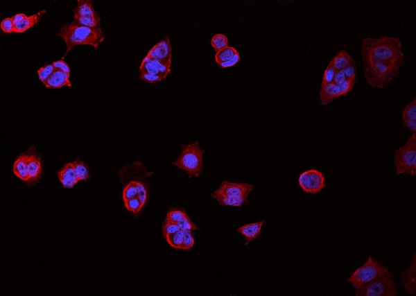 CD98/SLC3A2 Monoclonal Antibody (AN200219P)