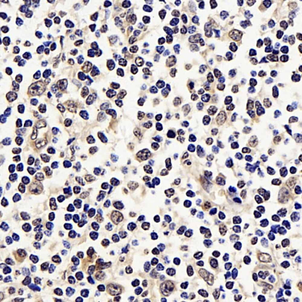 p21 Polyclonal Antibody (E-AB-70068)