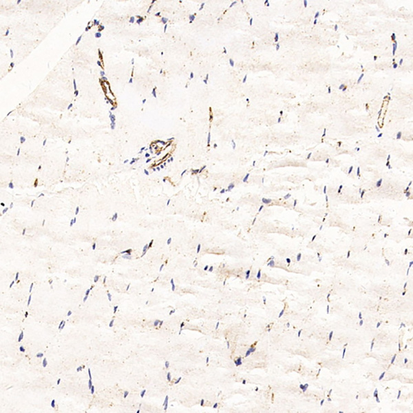 CD31 Monoclonal Antibody (E-AB-70173)