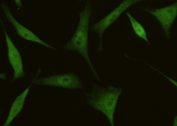 4E-BP1/EIF4EBP1 Monoclonal Antibody (AN200088P)