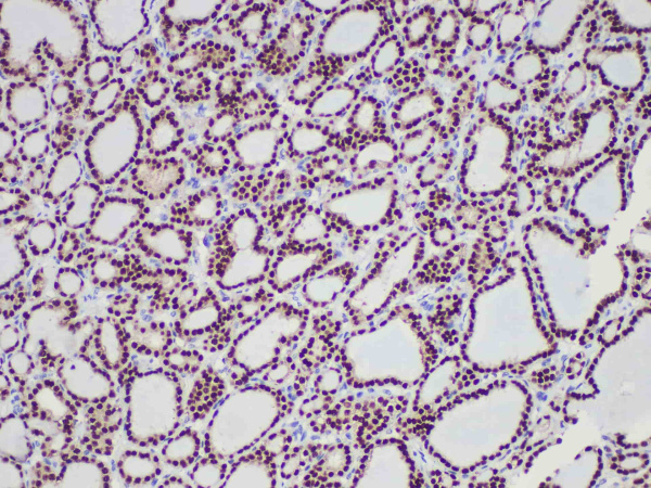 Pax-8 Monoclonal Antibody (ELAB6939-R)